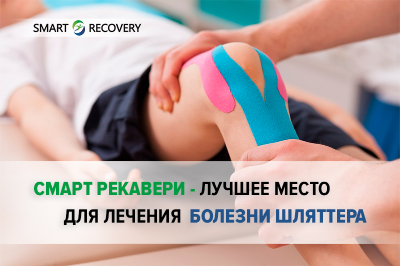 Смарт Рекавери — лучшее место для лечения Болезни Шляттера