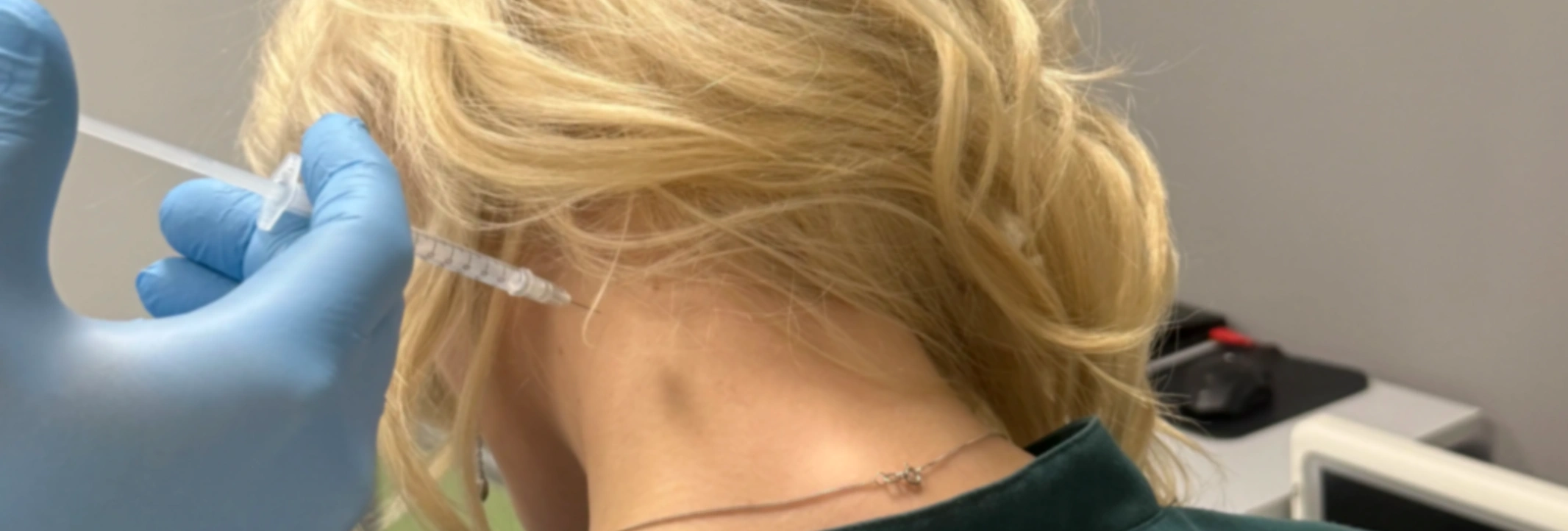 Ботулинотерапия — лечение спастичности, боли и мигрени препаратом Релатокс