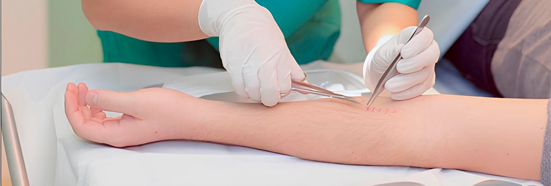 Снятие швов — профессиональная помощь после операции